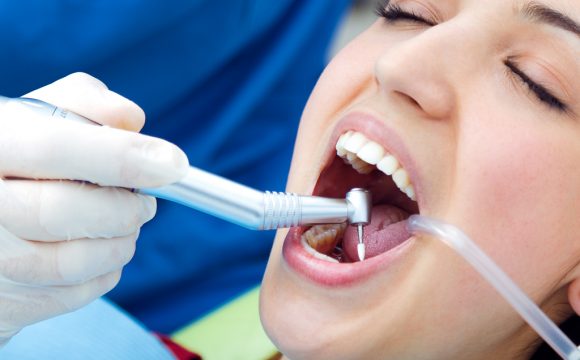 ¿Qué es el destartraje supragingival o limpieza dental?